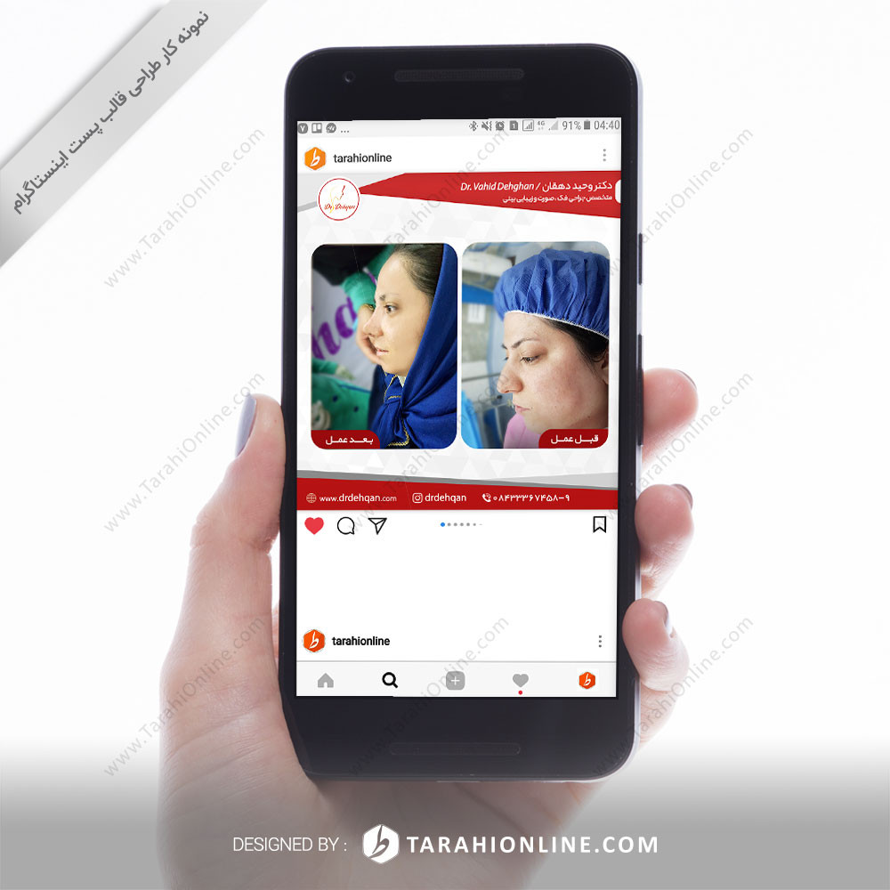 Instagram Post Template Design for Dr Dehghan