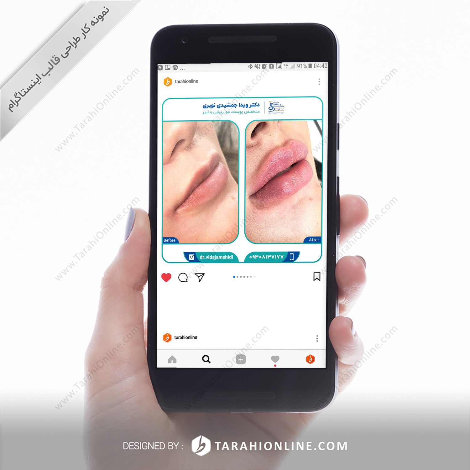 Instagram Post Template Design for Vida Jamshidi Instagramflyer