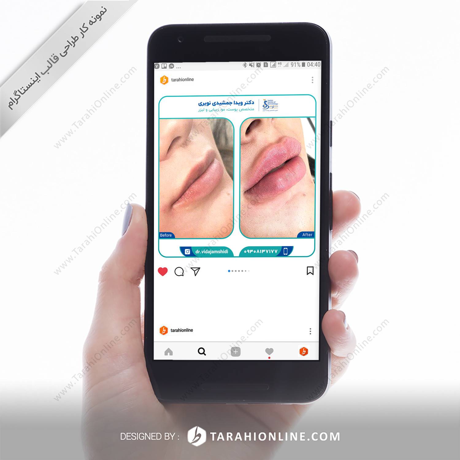 طراحی قالب اینستاگرام دکتر ویدا جمشیدی نویری