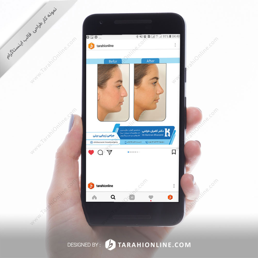 Instagram Post Template Design for Dr Kamran Khazaeni