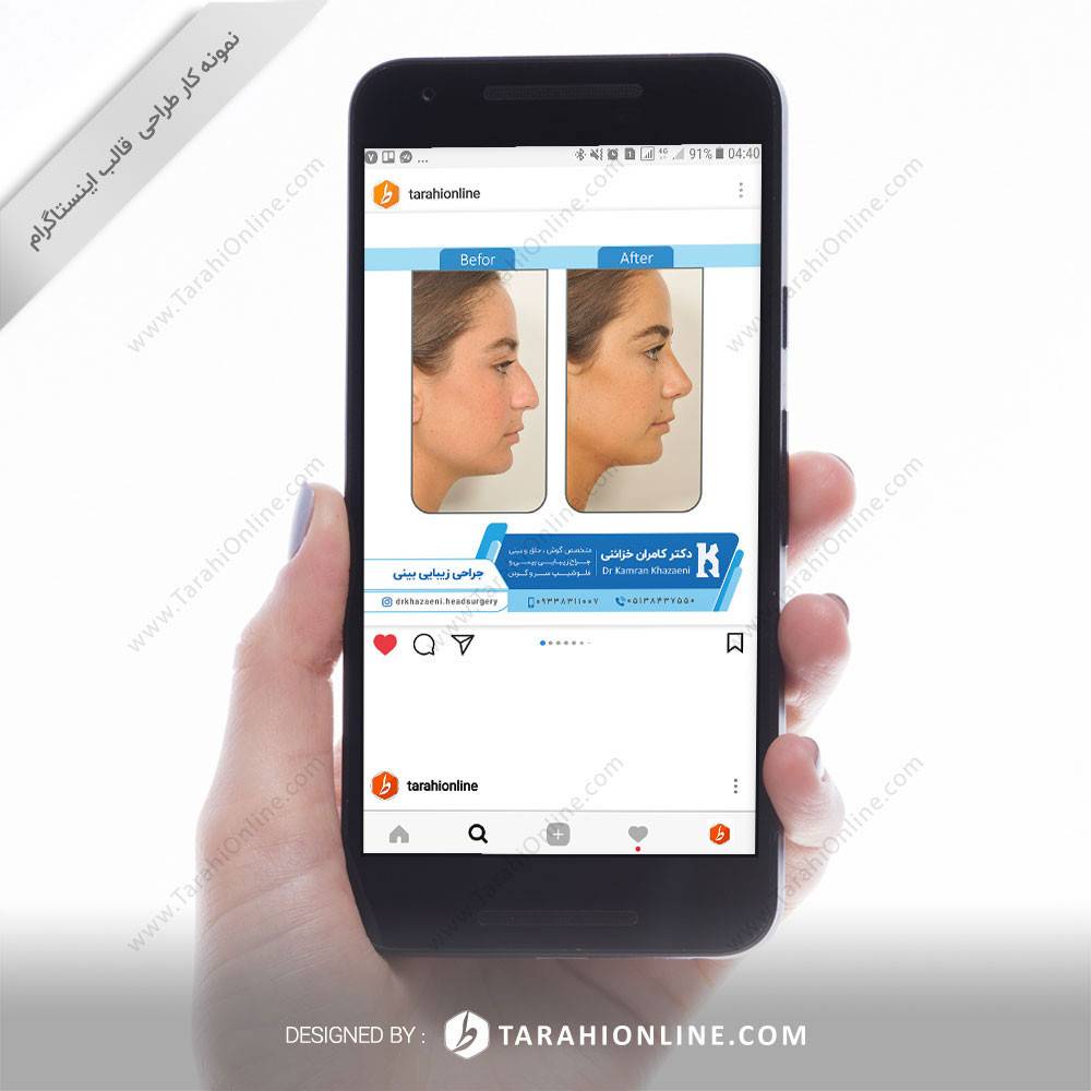 طراحی قالب اینستاگرام دکتر کامران خزائنی