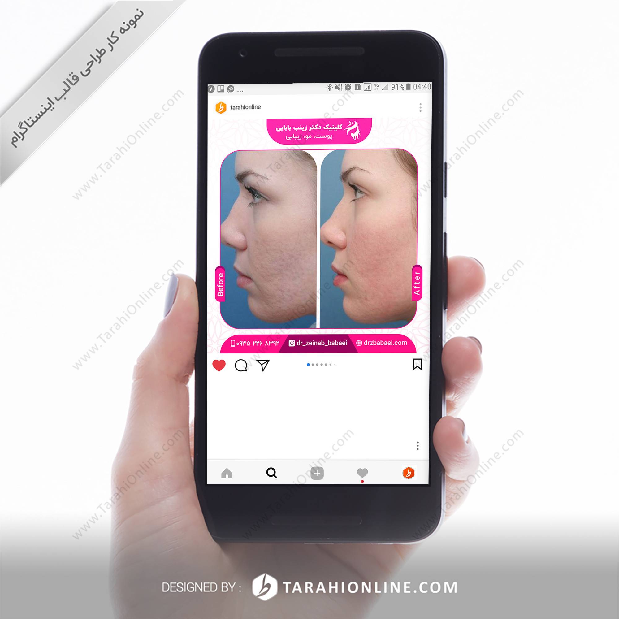 Instagram Post Design for Dr Zeinab Babaei - Image 3