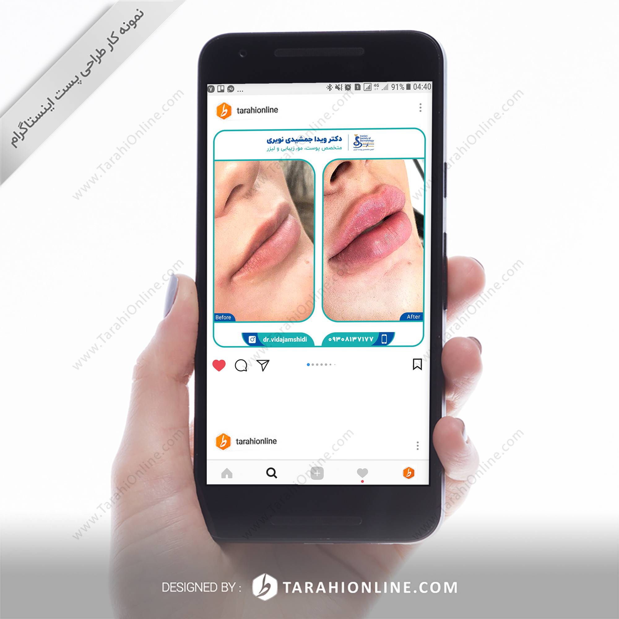 طراحی پست اینستاگرام دکتر ویدا جمشیدی نویری - تصویر 2