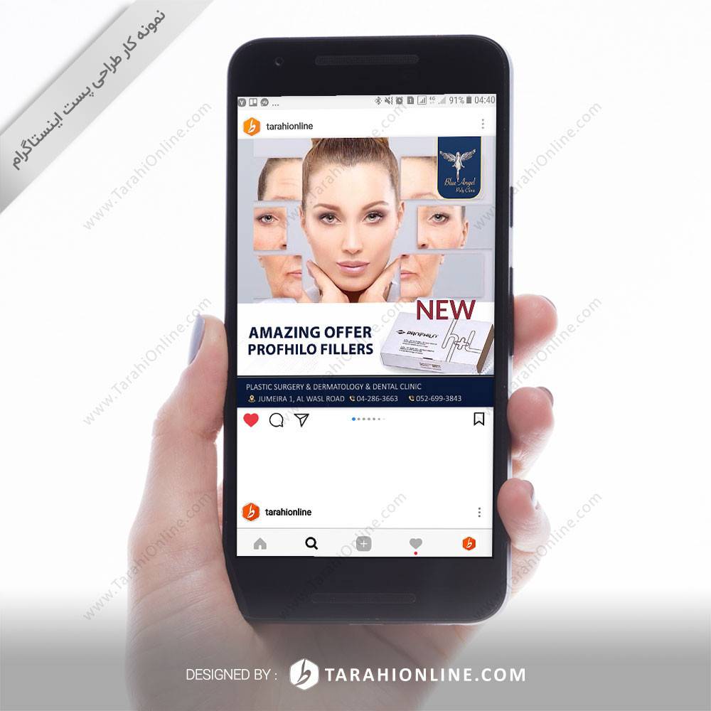 طراحی پست اینستاگرام بلو انجل ۱ - تصویر 3