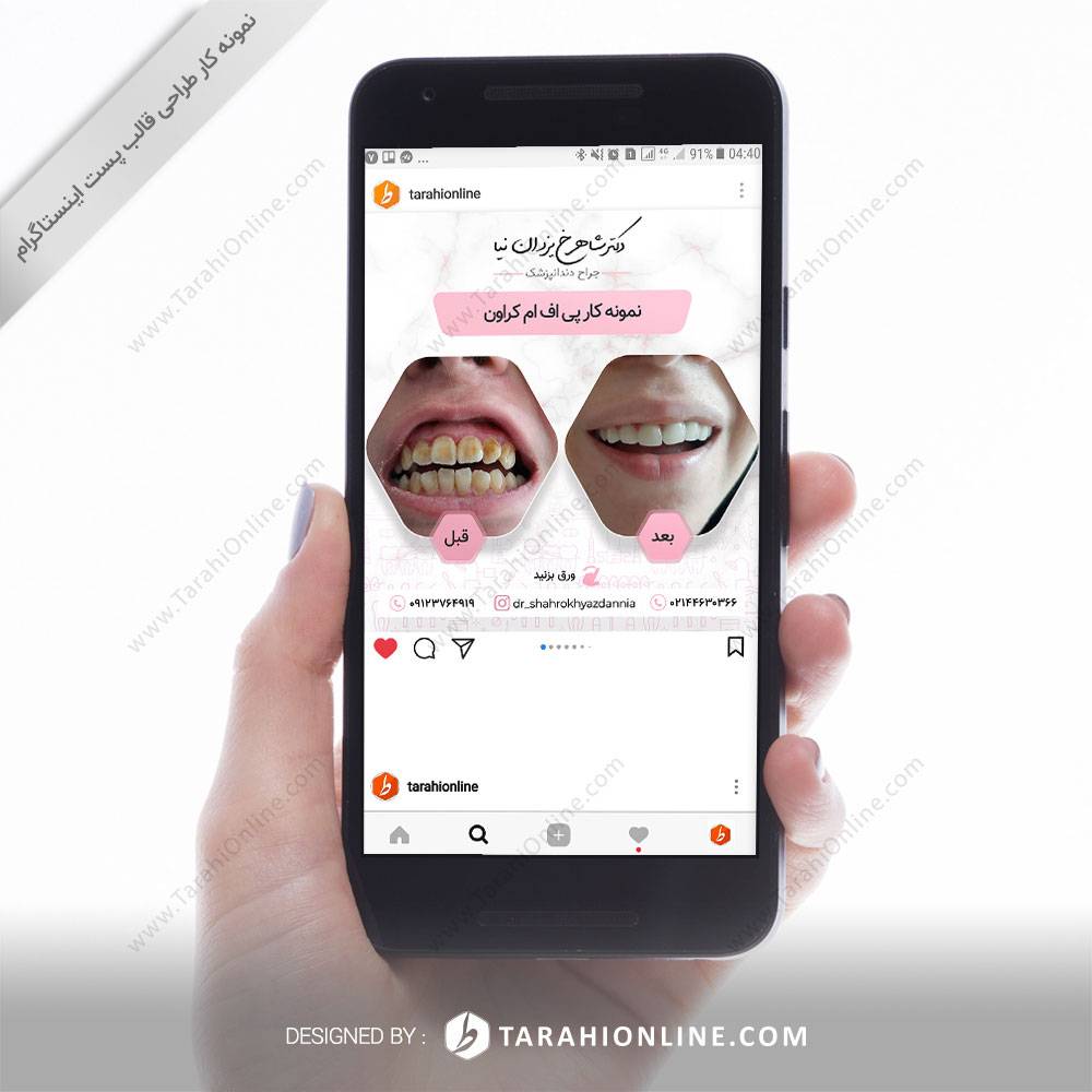 طراحی قالب استوری اینستاگرام دکتر شاهرخ یزدان نیا