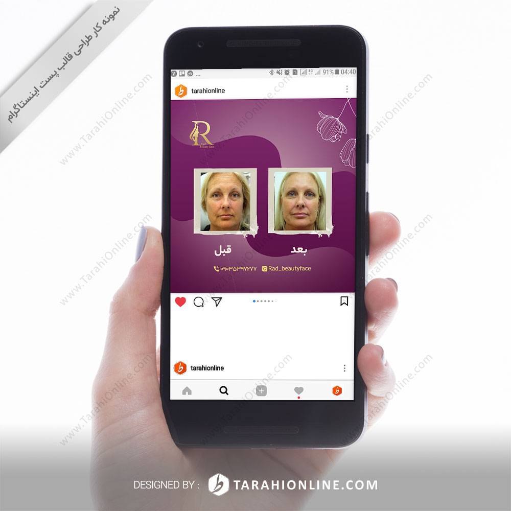 طراحی قالب اینستاگرام راد بیوتی فیس