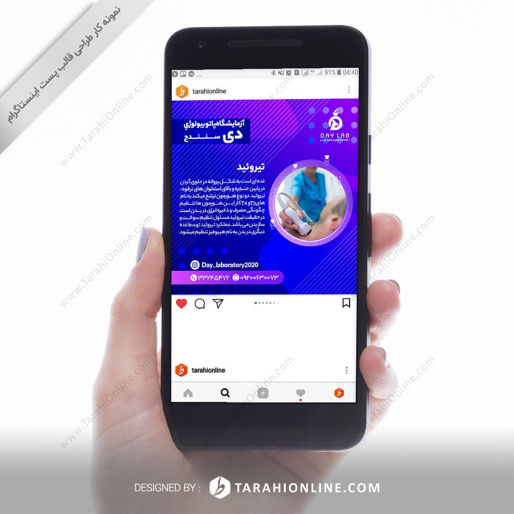 طراحی قالب اینستاگرام آزمایشگاه دی سنندج